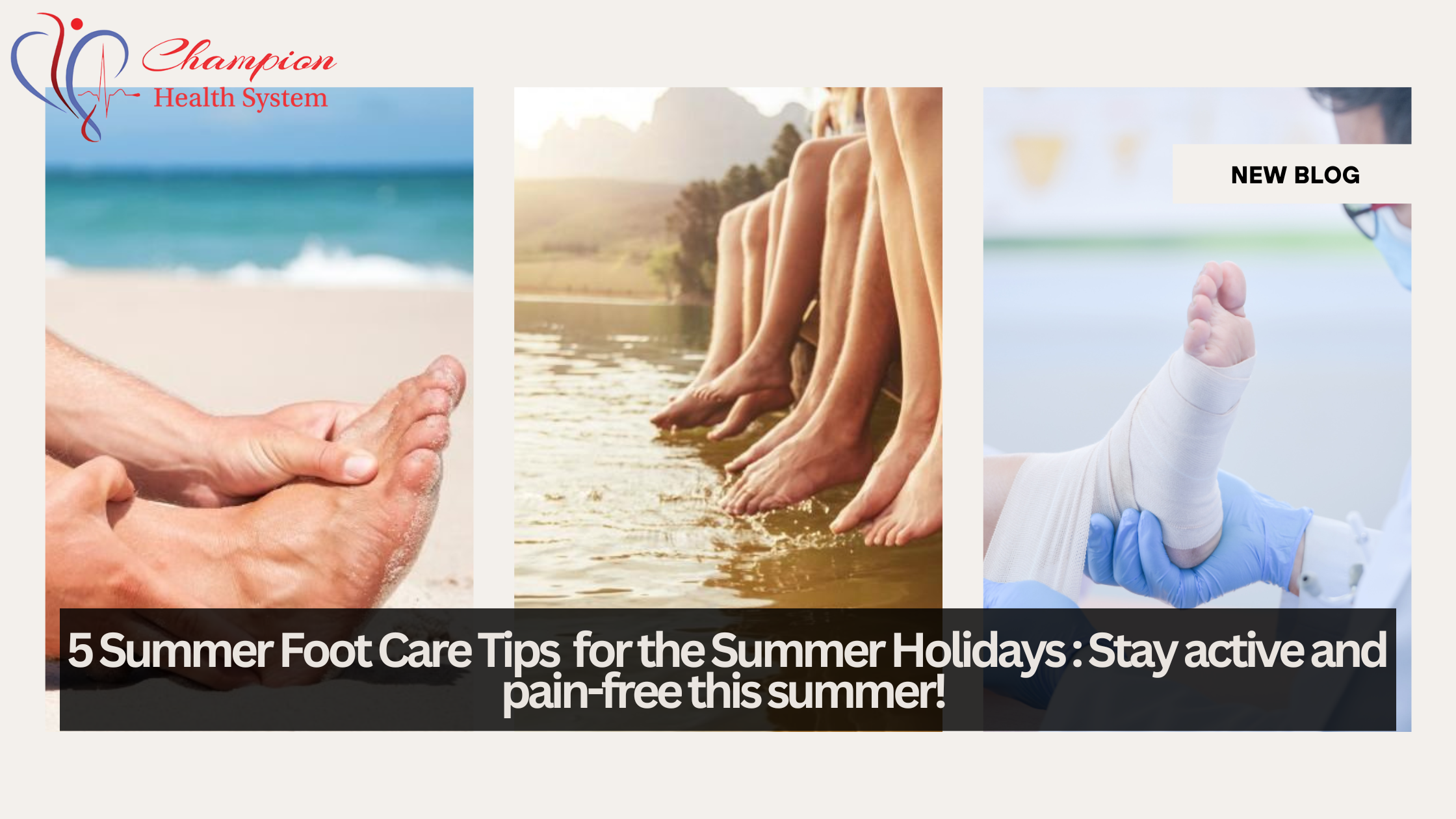 5 Foot Care Tips for Summer Blog Cover