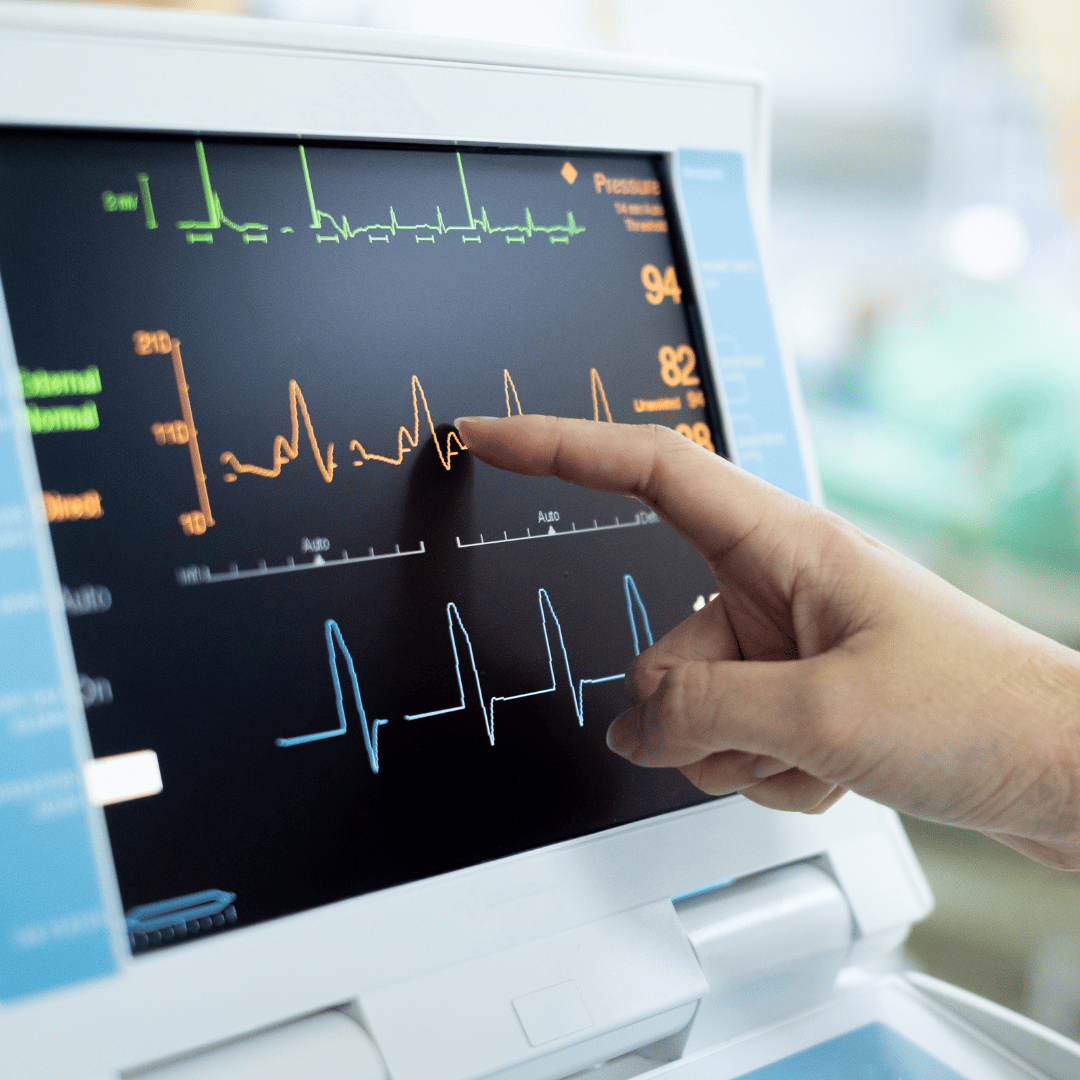 Champion Heart and Vascular Center Diagnostic Test (4)