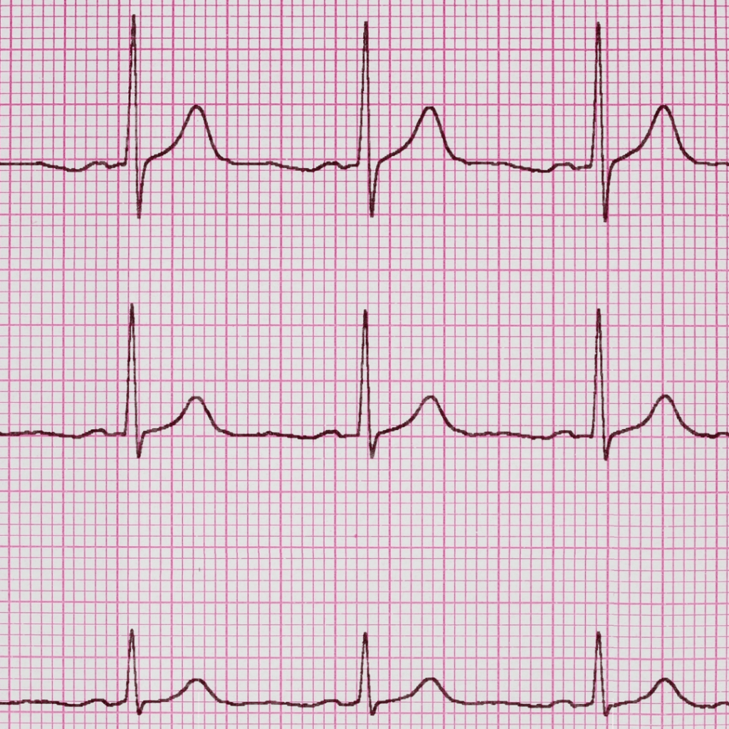 Champion Heart and Vascular Center Diagnostic Test (5)