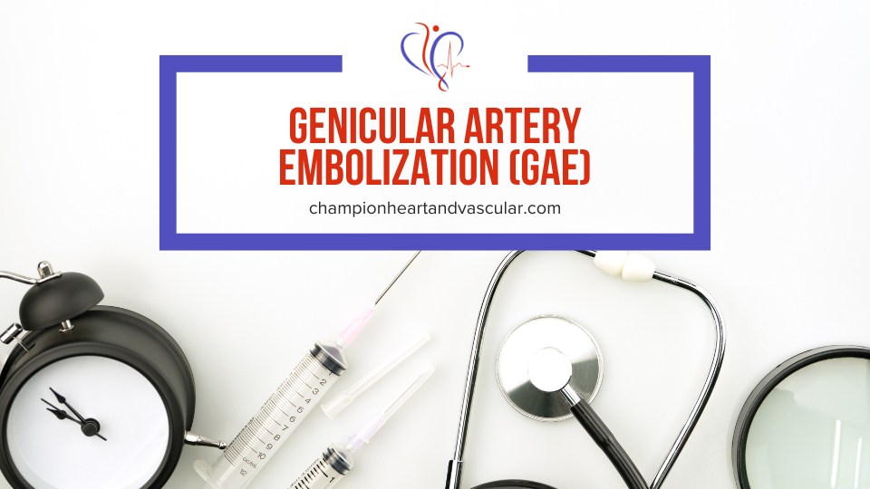 Understanding GAE: A Non-Surgical Solution for Knee Pain